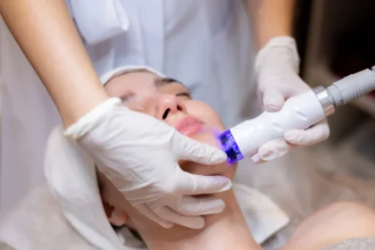 The Benefits of Combining Microneedling With Other Treatments