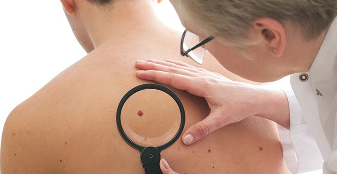 Understanding Skin Cancer Treatment Options
