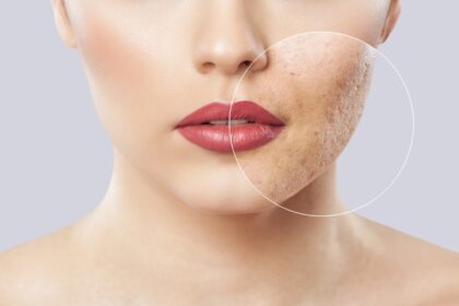 Understanding the Different Types of Skin Doctors and Their Specialties