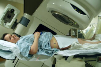 Who Should Get Radiation Therapy?