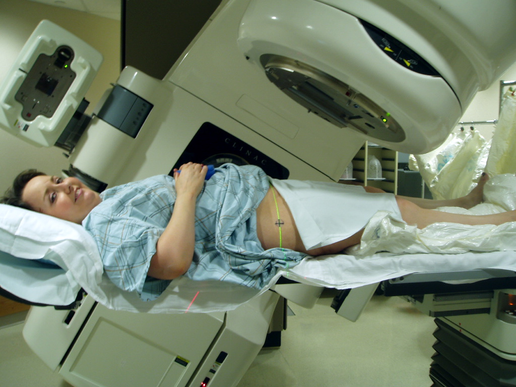 Who Should Get Radiation Therapy?