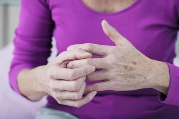 Effective Strategies for Arthritis Pain Management