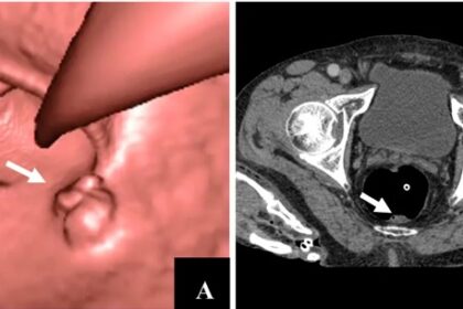Guidelines and Recommendations for Scheduling Your Colonoscopy