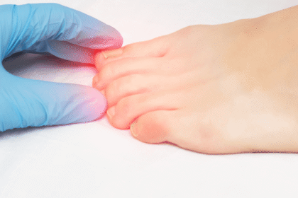 How To Manage Pain From Ingrown Toenails