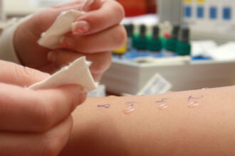 Navigating the Allergy Testing Process