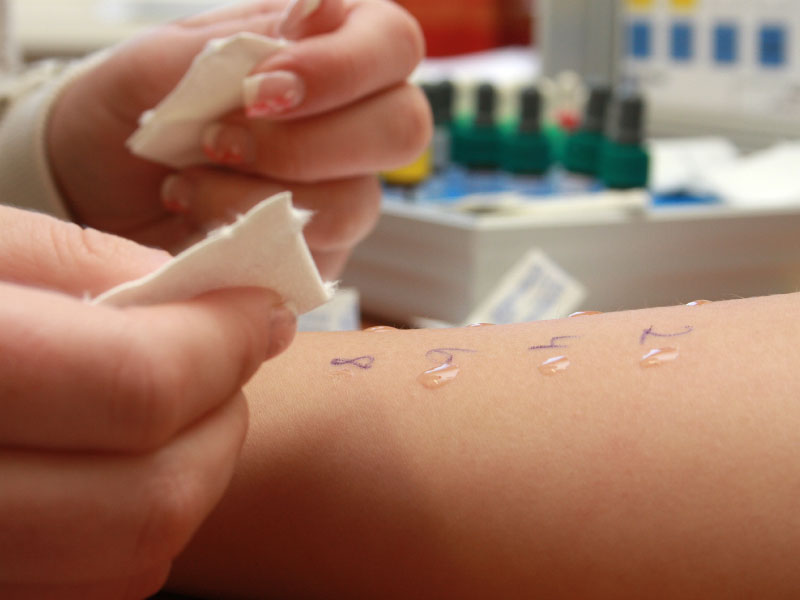 Navigating the Allergy Testing Process