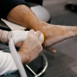 Recovering from Achilles Injuries