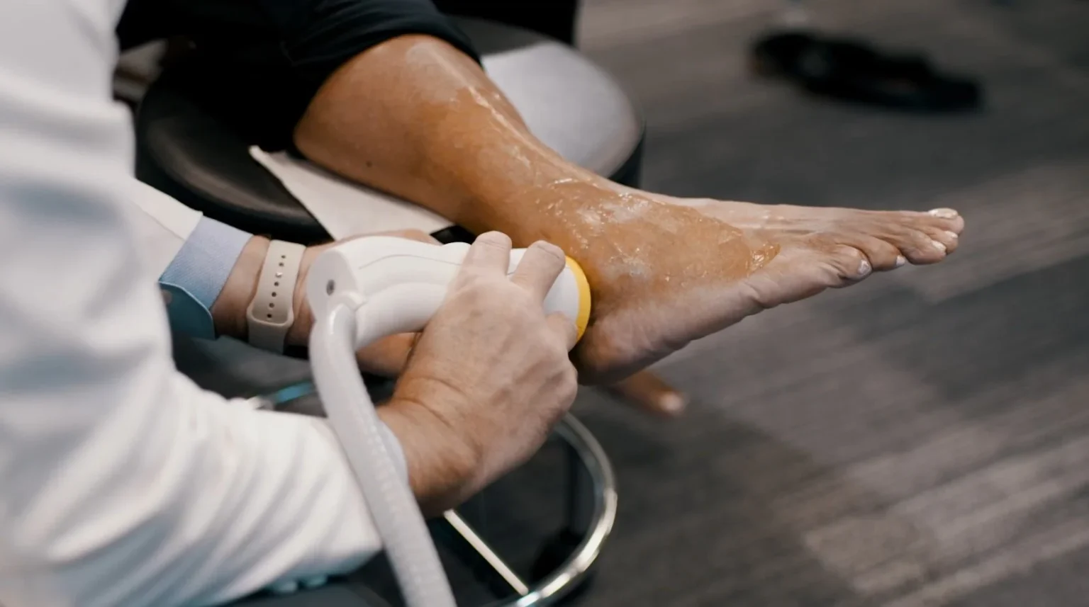 Recovering from Achilles Injuries